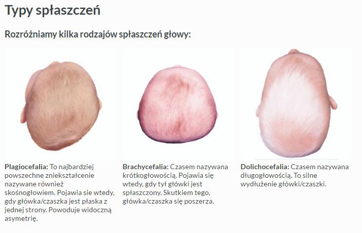 Mimos, Poduszka przeciw spłaszczaniu potylicy  M